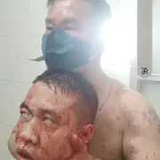 haitrungnguyen7