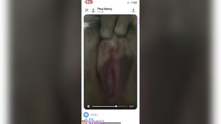 lồn thùy dương
