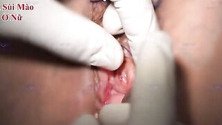 Khám phụ khoa cô u60