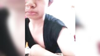 bé gái ome mup không lông