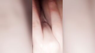 Dạ bé bị nung bím ạaa~~