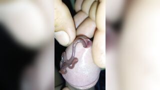 Thả giun chui vào cu