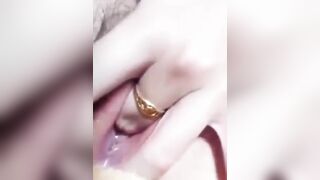 Thủ dâm 172