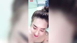 Missa lộ núm lộ mu hơi thâm p2
