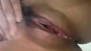 Lồn đái