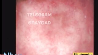 Nhét cá vào lỗ đít em gái