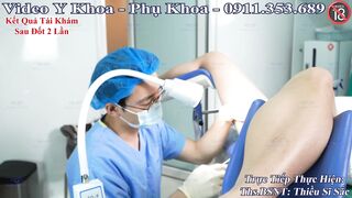Khám sùi mào gà