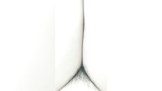 Đùi múp