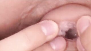 Núm vú cực to dị nhét vừa cả đầu cu