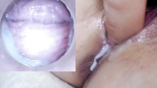 Sex toy gắn cam xem bên trong lồn đầy dâm thủy trắng xoá