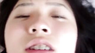 Địt em họ mới lớn đang niềng răng