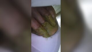 Móc lỗ đít