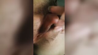 Hóa ra bị lòi le là có thật anh em ạ