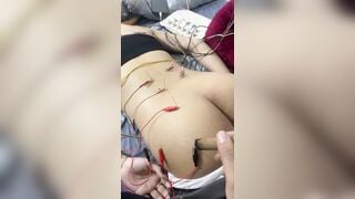 Quay lại cảnh châm cứu cho gái xinh mông to