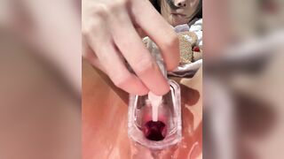 Dùng đồ y tế banh lỗ lồn ra cho các anh ngắm