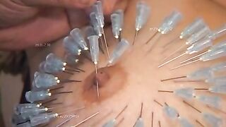XỎ KIM ĐẦY NGƯỜI