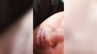 mỏ bú lol