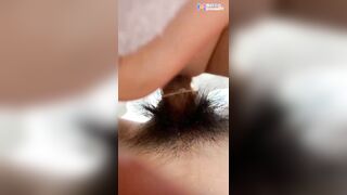 Tận tình chăm sóc em gái bệnh