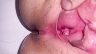 Chị gái khó ngủ