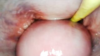 AMAZING INTERNAL POV. CAMERA INSIDE HER PUSSY WHILE I FILL HER WITH CUM